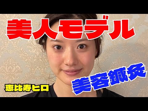 美容鍼うけてみた【美容】