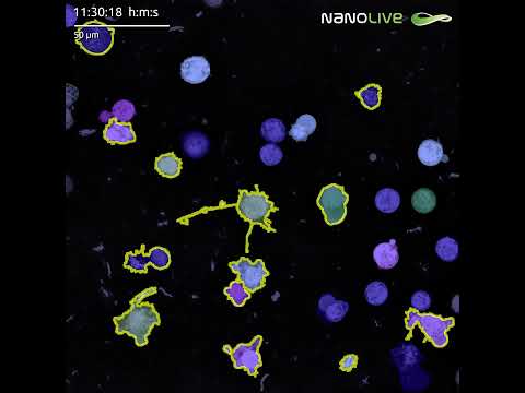 LIVE Cytotoxicity Assay subpopulation segmentation