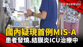 國內疑現首例MIS-A！30歲患者發燒.結膜炎ICU治療中 @globalnewstw