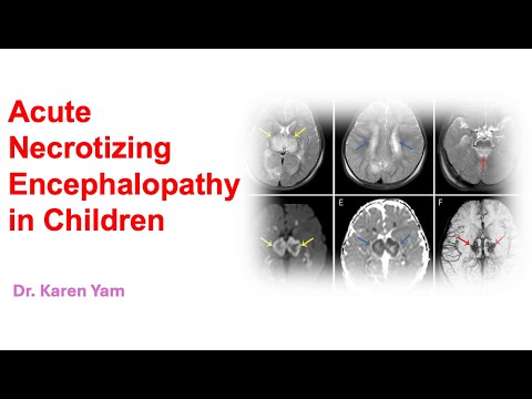 Acute Necrotising Encephalopathy in Children by Dr. Karen Yam (16 Dec 2024)