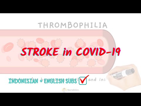 Acute Stroke in COVID-19 patient? Can it happen? | Neuroaholics