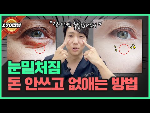 눈밑 지방, 눈밑 처짐! 돈 쓰지말고 집에서 해결하세요~ | 눈 밑이 불룩해지는 이유와 홈케어 방법