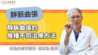 【靜脈曲張的幾種不同治療方法】楊志勛醫師／志勛皮膚科診所院長｜手術善其事