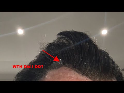 Oh Crap, This Happened To Your Hair Replacement Or Hair System | Lets Fix It