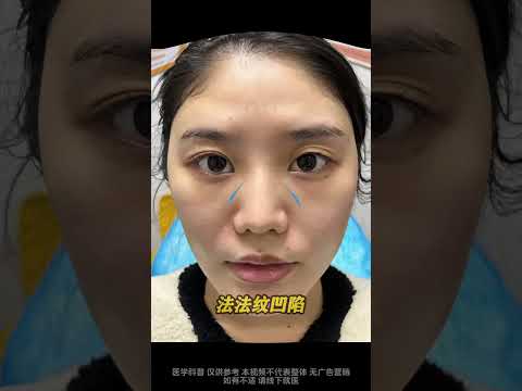 去变美了，大家看看变化大吗？