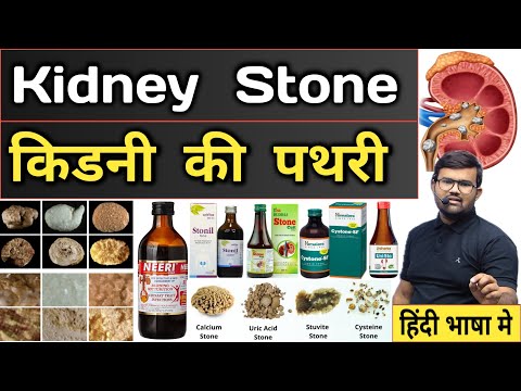 kidney Stone | किडनी की पथरी | Treatment | Medicine | Syrup | Kidney Stone Syrup | Medicine Use