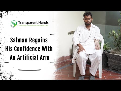 Salman’s Artificial Arm Was Fixed