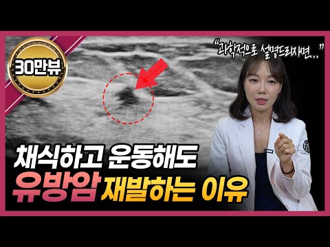 과학적으로 밝혀진 유방암 재발의 이유는 ‘이것’ 때문입니다!