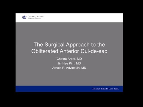 The surgical approach to the obliterated anterior cul-de-sac