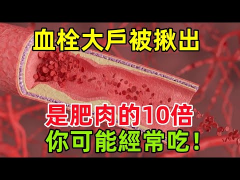 血栓「大戶」被揪出，是肥肉的10倍？你可能經常吃！#健康常識#養生保健#健康#健康飲食