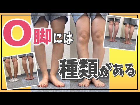 【O脚改善】O脚には種類がある！？これを知ることがO脚改善の第一歩～O脚を治す為に知っておくべき座り方とは！？～