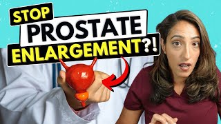 Best Ways to Prevent Prostate Enlargement, Explained by a Urologist