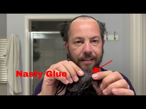 Hair Replacement Hair System Get The Glue Out Of The Hair During Cleanup