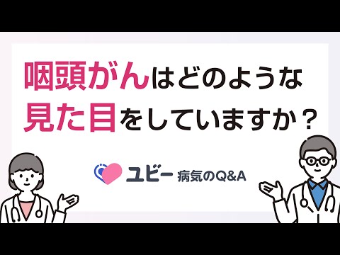 咽頭がんはどのような見た目をしていますか？【ユビー病気のQ&A】