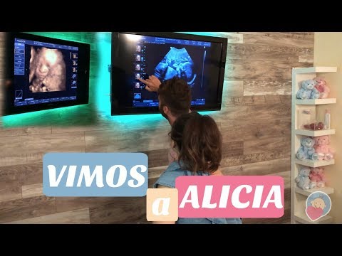 Taciele Alcolea viu o rostinho da ALICIA em Ultrassom 4D | MacroBaby