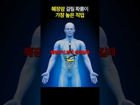 췌장암 걸릴 확률이 제일 높다는 이 ’직업‘