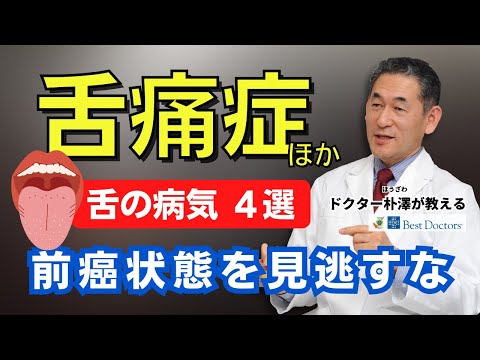 【医師解説】前癌状態を見逃すな「舌の病気４選」