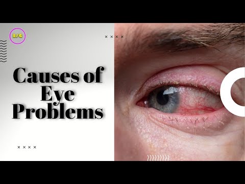 CAUSES OF EYE PROBLEMS #shorts #eyedoctor #healthcare #optical #eyetreatment #lowvision #eyeproblem