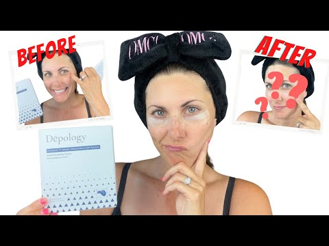 Do Depology Micro Dart Eye Patches Work? | Before & After Results!