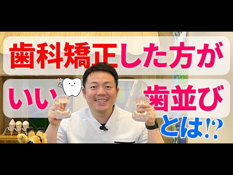 歯科矯正した方がいい歯並びとは❓気になる小児矯正🦷最年少は何歳❓模型で解説します✨