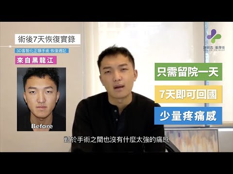 改善戽斗臉型-7天回診紀錄謝明吉醫師正顎手術