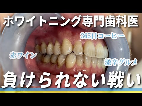 【最強】白くできない歯は存在しない！コーヒーを飲んでも大丈夫なホワイトニング【1本550円～できちゃう】