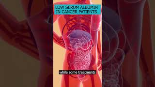 What does low serum albumin mean for a cancer patient? #albumin  #CancerTreatment