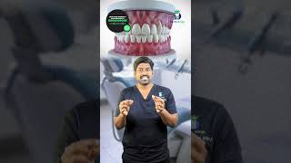 இறங்கிய பல் ஈறு! சரி செய்வது எப்படி? - Gingival Grafting for Recession |Dr. Karthikeyan |Denta Kings