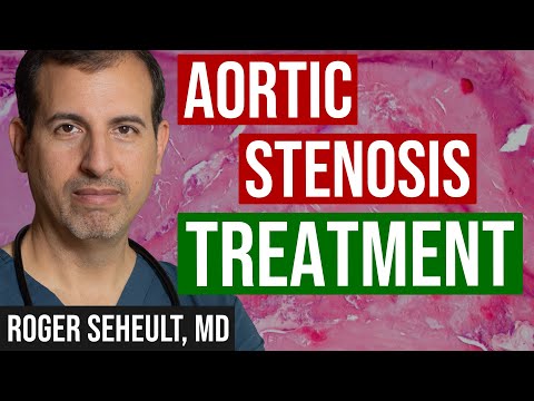 Aortic Stenosis Treatment: TAVR - How It Is Done