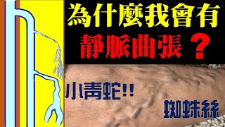 靜脈曲張如何形成｜許原彰醫師：台中，高雄，台南，台北，新竹，靜脈曲張專家