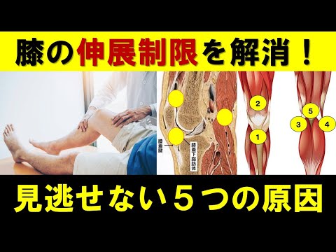 膝の伸展制限を解消！驚くべき5つの原因を徹底解説