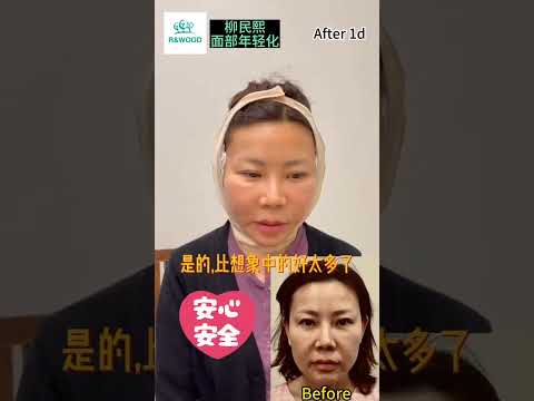 面部年轻化后第一天的访谈新鲜出炉啦~让我们第一时间来听听亲身经历者怎么说？是否会有痛感？淤青、肿胀严重吗？不要着急，让我们一一听她来讲述~跟着我们轻林直击第一现场，跟着我们轻林开启变美之路！