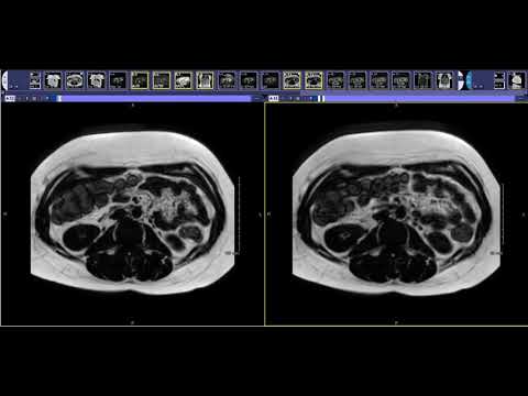 How to read a Liver MRI