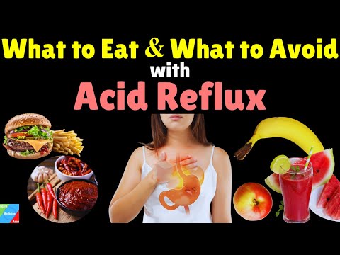 What to Eat & What to Avoid with Acid Reflux | Best & Worst Foods for Acid Reflux/GERD/GORD