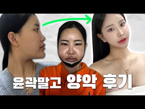 양악 힘든건 알았는데 이정도라고?😂😂[다혜2Vlog]