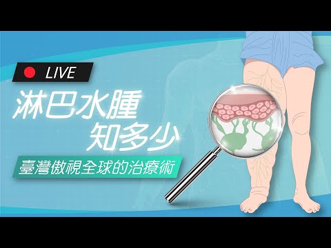 淋巴水腫知多少 - 臺灣傲視全球的治療術 | James On Air