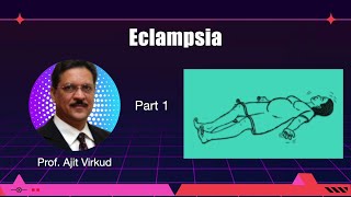 Eclampsia Masterclass Part 1