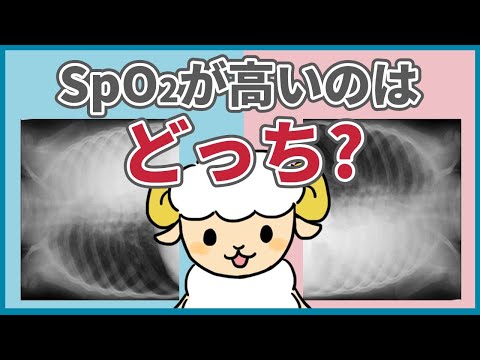 【質問コーナー】無気肺でSpO2が高くなる体位