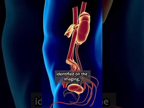 These Tests Find the Cause of Blood in Your Urine #urology #urologist #bloodinurine #hematura