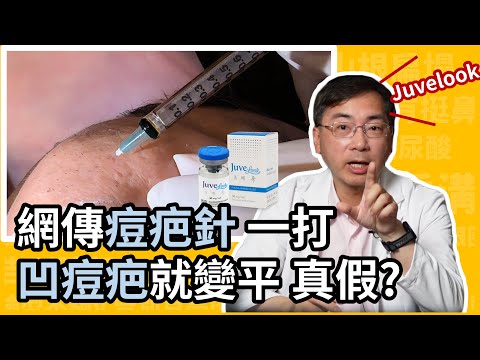 凹痘疤治療新突破，網傳超夯痘疤針，真的有效嗎？如何用 Juvelook 喬雅露改善凹痘疤？