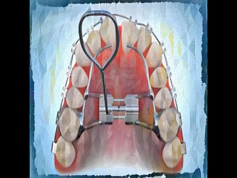 Negentropic Maxilla Masterwork - Sapien medicine