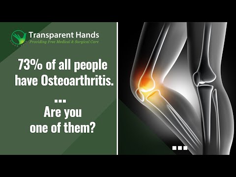 Understanding Osteoarthritis: Symptoms and its Risk Factors