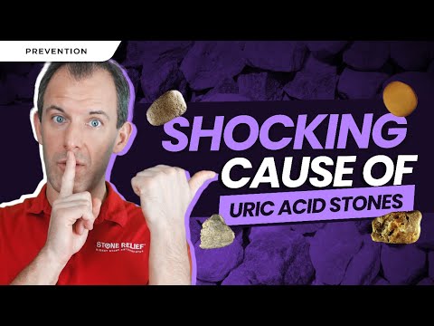 Uric Acid Stones are due to Metabolic Syndrome?