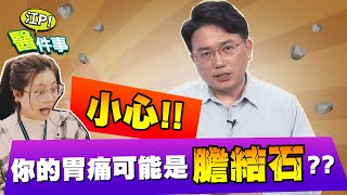 小心！胃痛可能是膽結石？3招教你分辨 【江P醫件事#25】