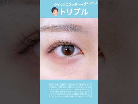 形成外科専門医が行う二重術！！二重のことなら大宮東口院福田医師にお任せ！クリニック大人気のクイックコスメティークトリプルであなたも理想の二重に！#形成外科専門医 #二重整形 #二重埋没