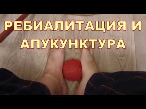 РЕБИАЛИТАЦИЯ И АПУКУНКТУРА 🦶🦶