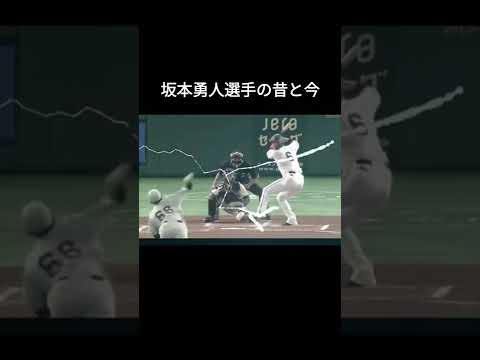 坂本勇人選手の昔と今