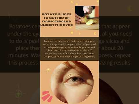 Get rid of Dark Circles.