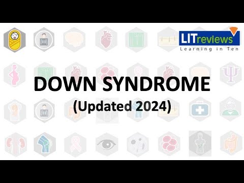 (New) Down Syndrome