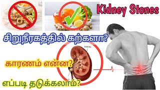 kidney stone treatment in tamil/kidney stone treatment in tamil food/kidney stone symptoms in tamil